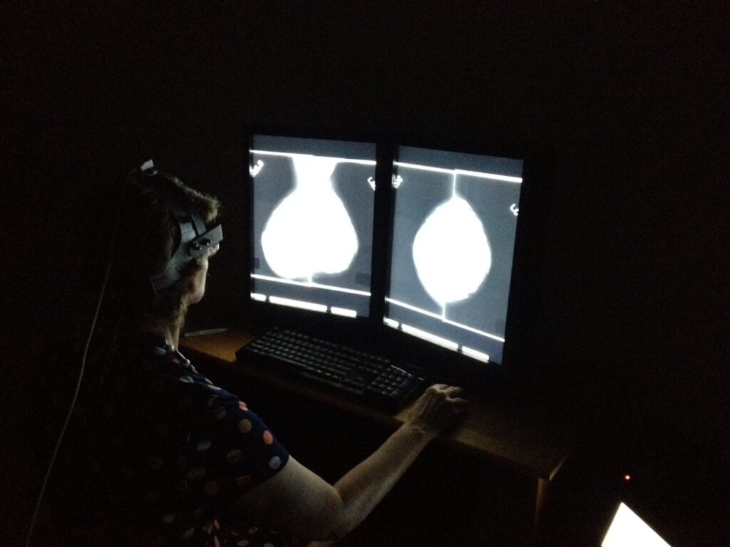 Mammogram ai powered